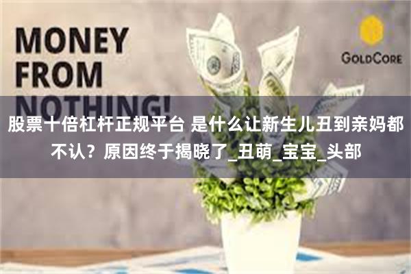 股票十倍杠杆正规平台 是什么让新生儿丑到亲妈都不认？原因终于揭晓了_丑萌_宝宝_头部